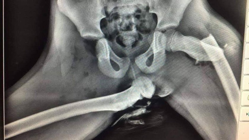 Voeten op het dashboard laten rusten: “Gruwelijke verwondingen”