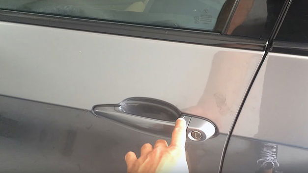 Un homme poursuit BMW pour un pouce sectionné